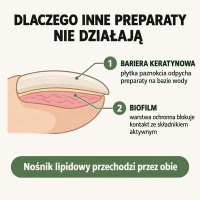 Dlaczego inne preparaty nie działają — bariera keratynowa i biofilm